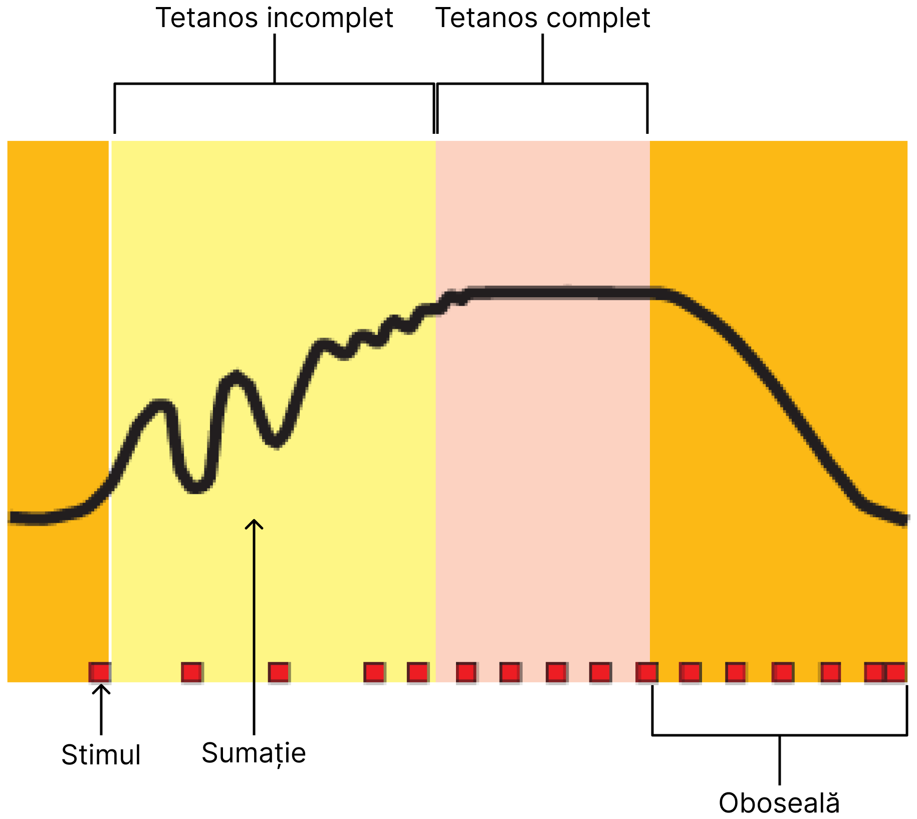 Tetanos.